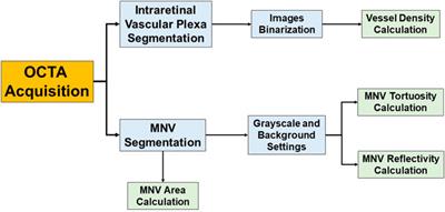 Optical Coherence Tomography Angiography Parameters Correlated to the Growth of Macular Neovascularization in Age-Related Macular Degeneration